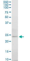 Monoclonal Mouse anti-Human APG5 / ATG5 Antibody (clone 3G11, WB)