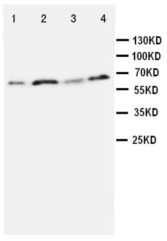 SPP1 / Osteopontin Antibody (aa28-47)