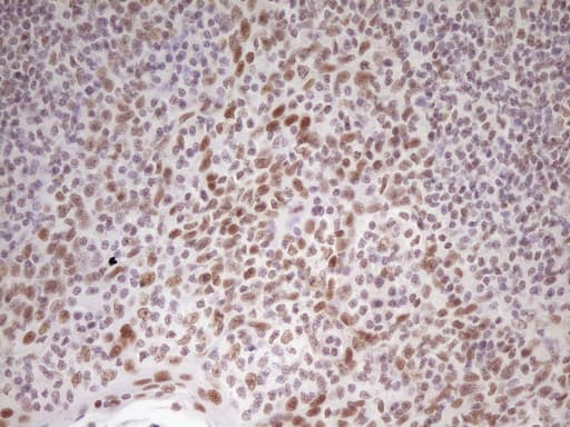 HMG20A Antibody (aa1-281, clone OTI2H4)