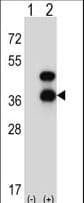 CD72 Antibody (aa176-203)