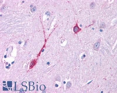 PathPlus™ GPR80 / GPR99 / OXGR1 Antibody (N-Terminus)