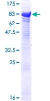 Human TRIM16 Protein (Recombinant GST)