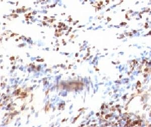 CDKN1B / p27 Kip1 Antibody (clone KIP1/769)