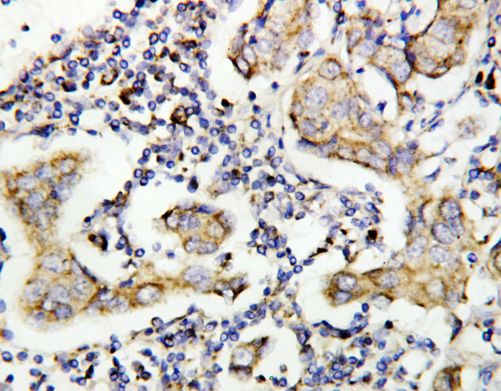 Polyclonal Rabbit anti-Human CASP8 / Caspase 8 Antibody (aa458-473, IHC, WB)