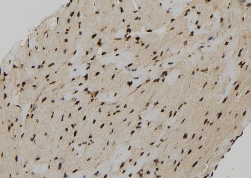 Polyclonal Rabbit anti-Human PPP3R2 Antibody (IHC, WB)