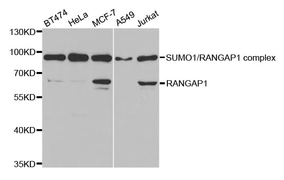 Polyclonal Rabbit anti-Human RANGAP1 Antibody (IHC, IF, WB)