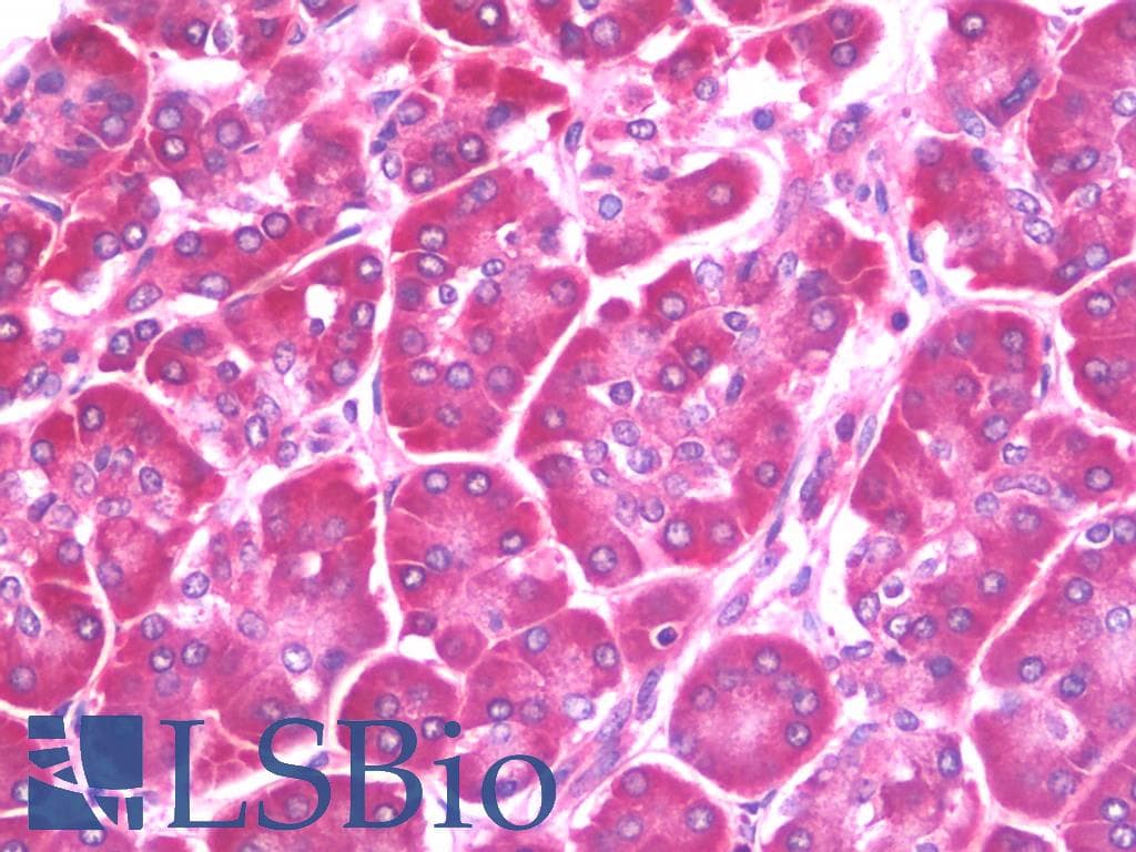 IHC-plus™ Monoclonal Mouse anti-Human KRT19 / CK19 / Cytokeratin 19 Antibody (clone AT13D10, IHC, WB)