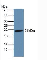 HFE2 / Hemojuvelin Antibody