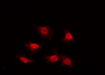 Polyclonal Rabbit anti-Human PIK3R1 / p85 Alpha Antibody (IHC, IF, WB)