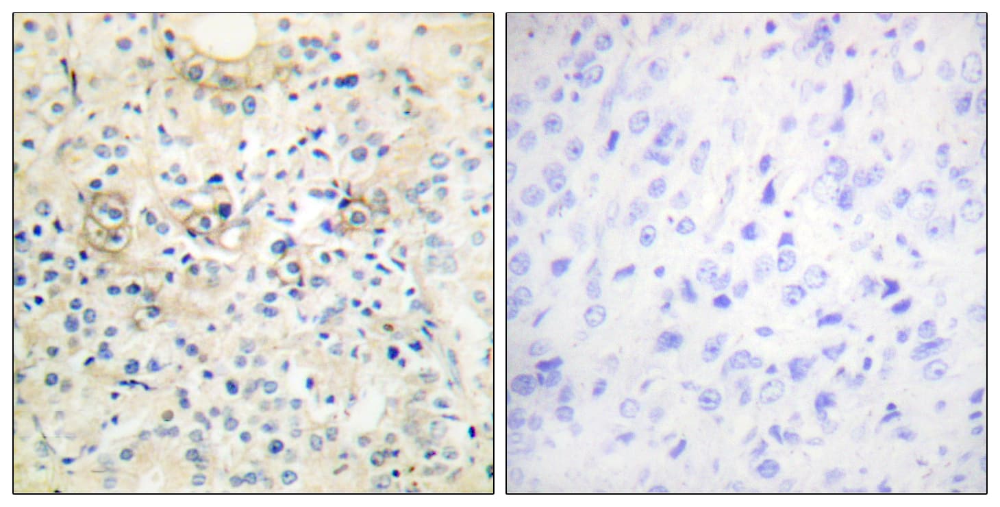Polyclonal Rabbit anti-Human ANO7 / TMEM16G / NGEP Antibody (aa881-930, IHC, IF)