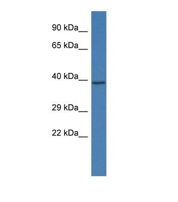 STYK1 Antibody (aa145-194)