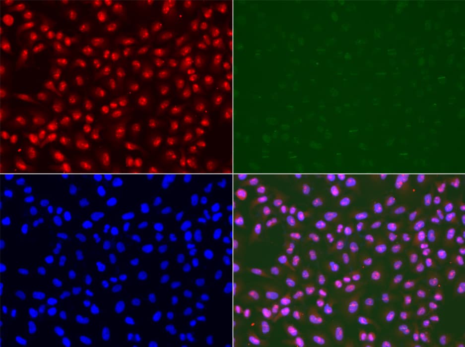 RAD50 Antibody
