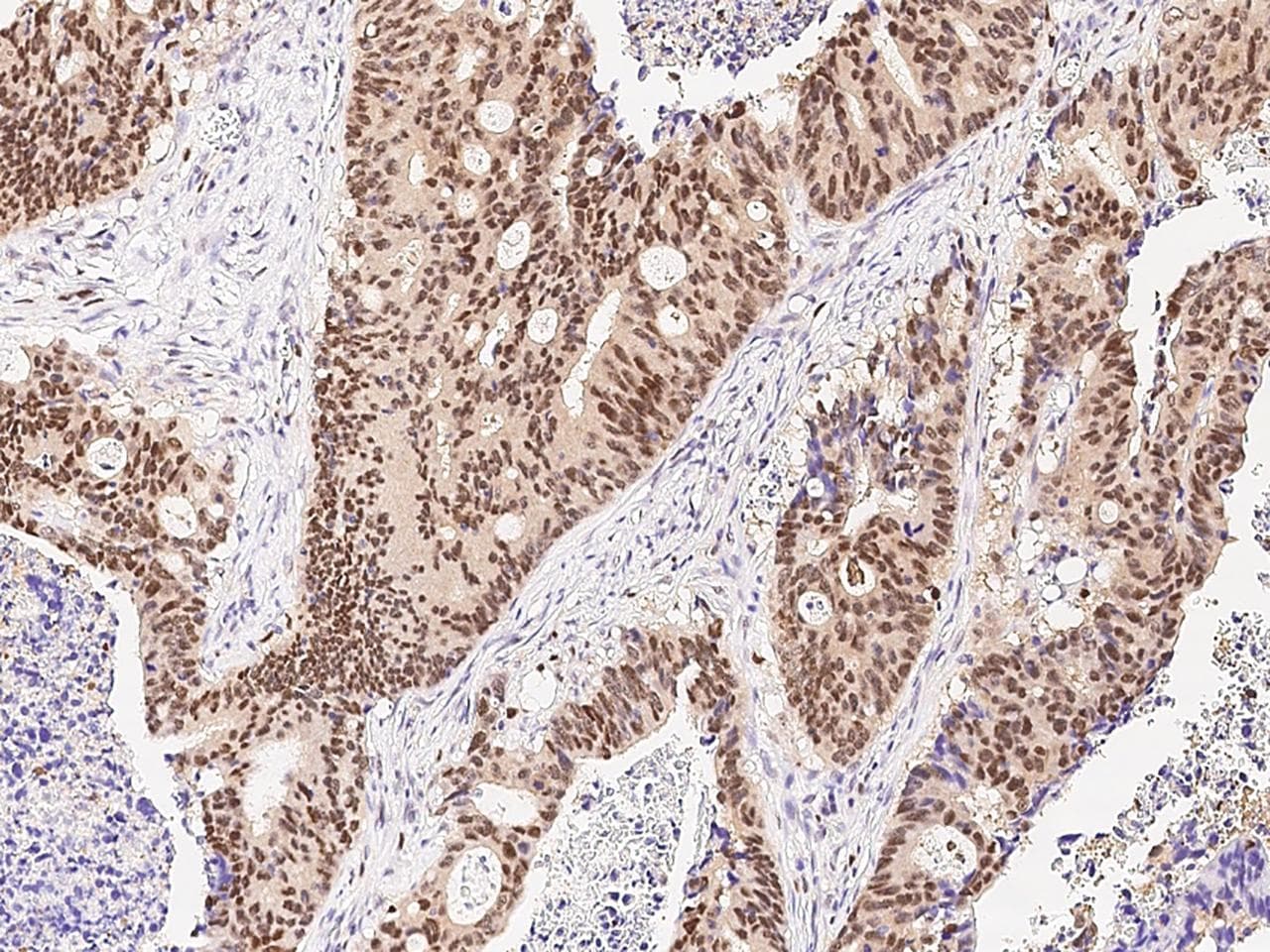 ARL4A / ARL4 Antibody (Preservative Free)