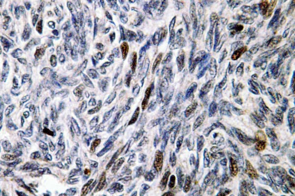 Polyclonal Rabbit anti-Human MCM4 Antibody (Pro50, IHC, WB)