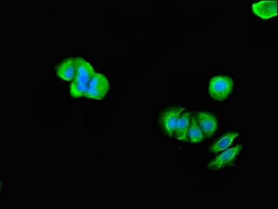 TMX2 / TXNDC14 Antibody