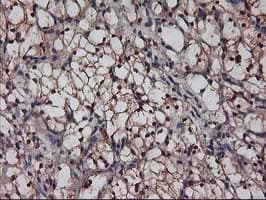 AKT1 Antibody (clone OTI4C11)