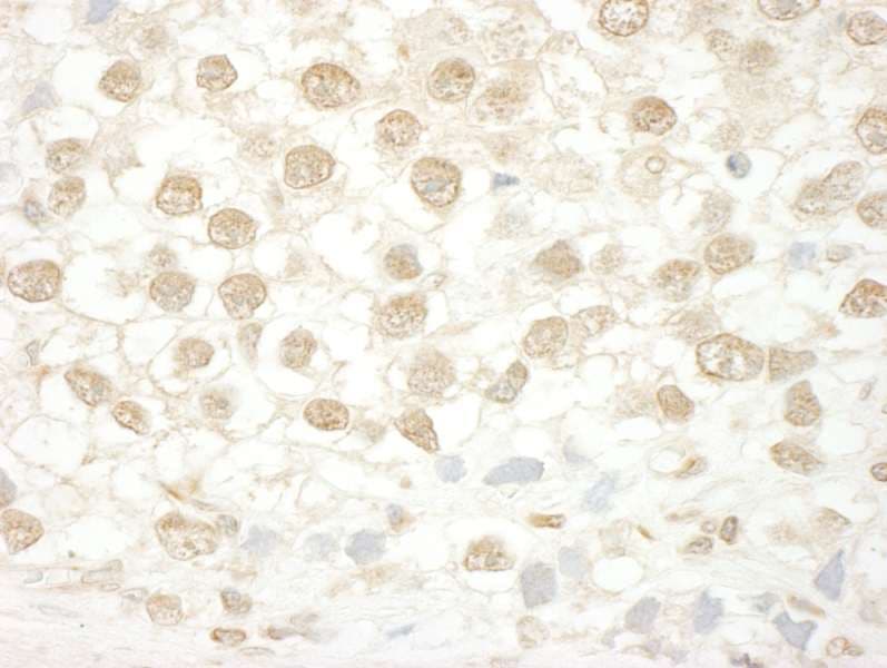 ENL / MLLT1 Antibody (aa325-375)