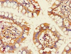 Polyclonal Rabbit anti-Human ACAD9 Antibody (aa1-270, IHC, WB)