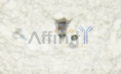 ERBB4 / HER4 Antibody