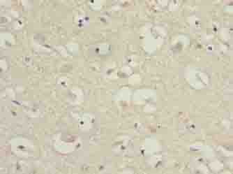 Polyclonal Rabbit anti-Human CKLFSF5 / CMTM5 Antibody (IHC)