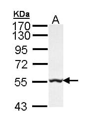 IHC-plus™ GLYCTK / Glycerate Kinase Antibody (aa144-523)