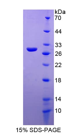 Rat MYO1F Protein (Recombinant His-T7)