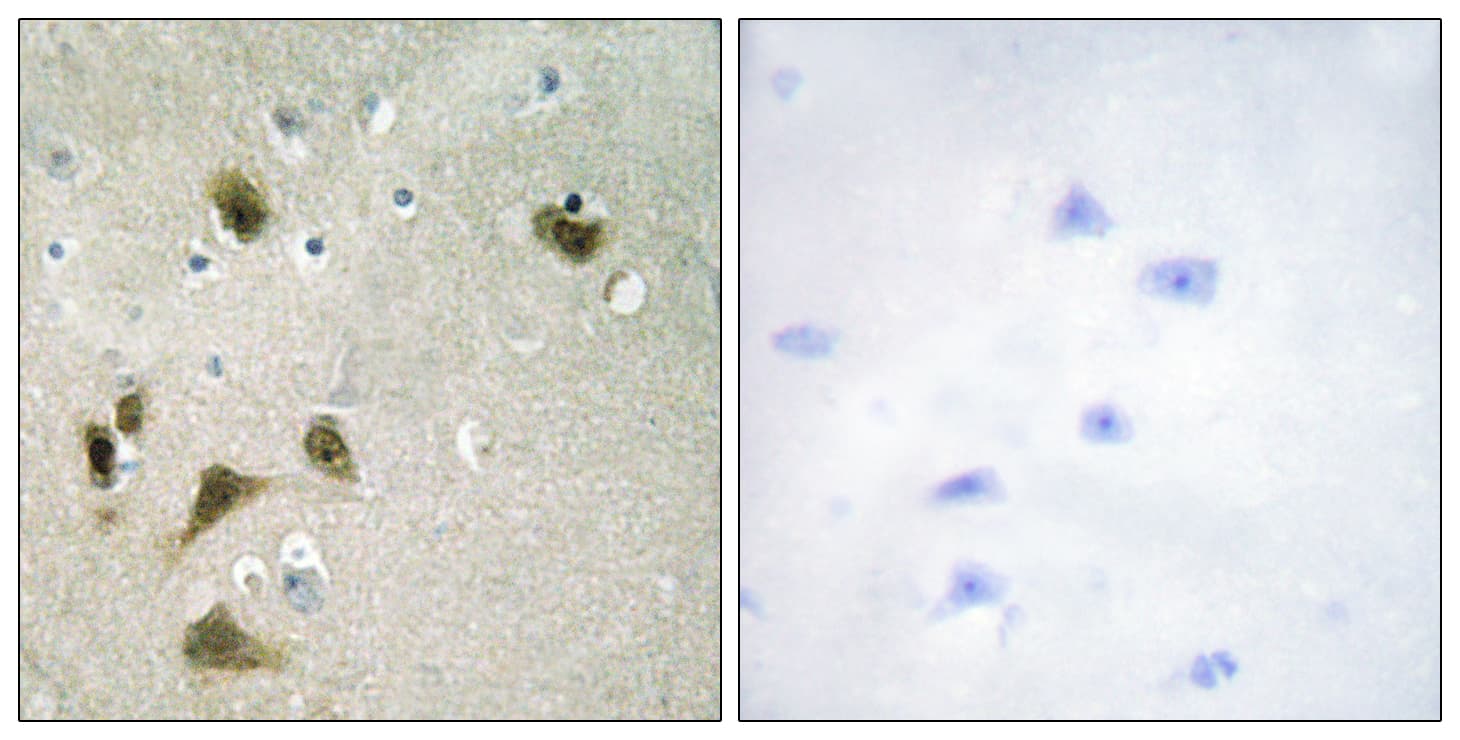 BIRC5 / Survivin Antibody (phospho-Thr117)