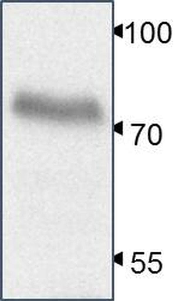 Monoclonal Mouse anti-Human YAP / YAP1 Antibody (clone 1A12, IHC, WB)