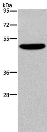 IHC-plus™ Polyclonal Rabbit anti-Human PVRL4 / Nectin 4 Antibody (aa371-510, IHC, WB)