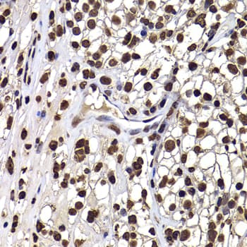 Polyclonal Rabbit anti-Human DNAJB6 Antibody (IHC, IF, WB)