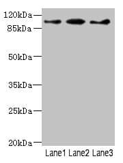 PHKG2 Antibody