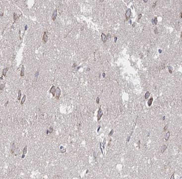 SUMO1 / SMT3 Antibody