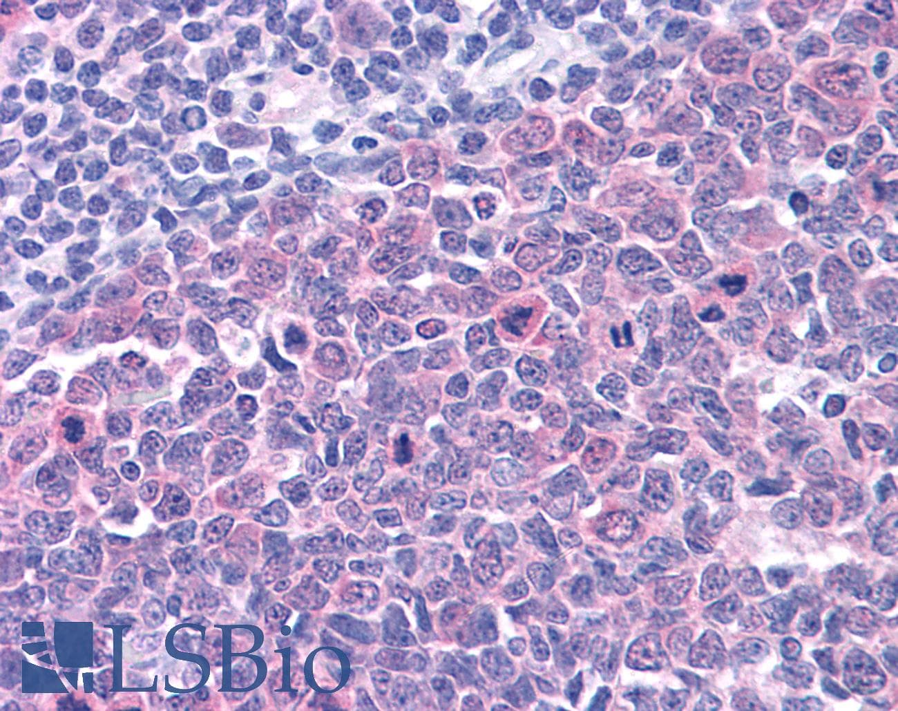 PathPlus™ SMARCA4 / BRG1 Antibody (C-Terminus, clone BRG-01)