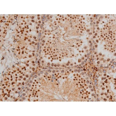 CREB1 / CREB Antibody (phospho-Ser133)