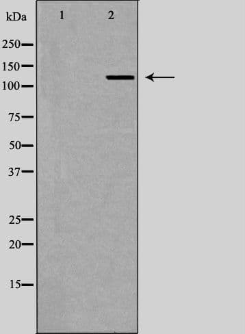RENT1 / UPF1 Antibody