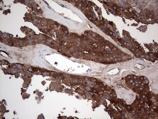 GARS / Glycyl tRNA Synthetase Antibody (clone OTI4G4)