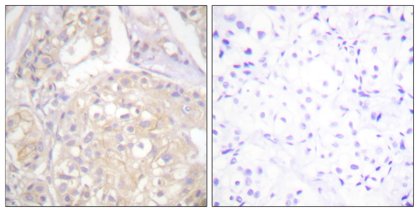 FGFR1 / FGF Receptor 1 Antibody (phospho-Tyr766)
