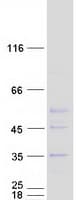 Human ELP6 Protein (Recombinant Myc-DDK (Flag))