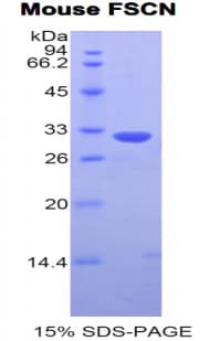 Mouse FSCN1 / Fascin Protein (Recombinant His)