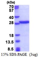Human PABPN1 / PABP2 Protein (Recombinant His)