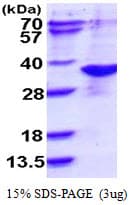 Human NAA10 / ARD1A Protein (Recombinant His)