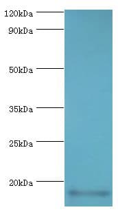 IHC-plus™ Polyclonal Rabbit anti-Human CALML5 Antibody (aa1-146, IHC, WB)