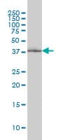 Monoclonal Mouse anti-Human POLR1C / RPA39 Antibody (clone 3A5-H2, IHC, IF, WB)