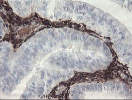 F13A1 / Factor XIIIa Antibody (clone OTI3E3, Carrier-free)