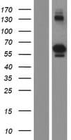 ACD / PTOP Protein (Over-Expression Lysate Myc-DDK (Flag))