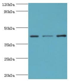 Polyclonal Rabbit anti-Human SERPINB1 Antibody (aa100-379, IHC, WB)