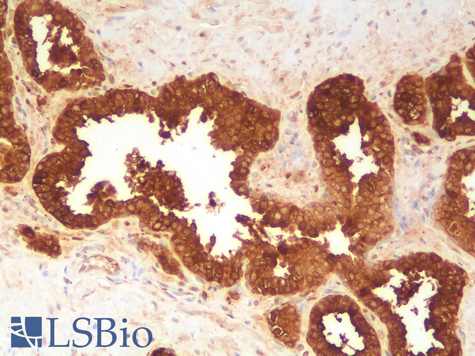 PathPlus™ Recombinant Monoclonal Rabbit anti-Human KLK3 / PSA Antibody (clone KLK3/2871R, IHC)