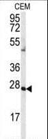 Polyclonal Rabbit anti-Human AK2 / Adenylate Kinase 2 Antibody (aa1-30, IHC, WB)