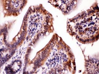 LDHA / LDH1 Antibody
