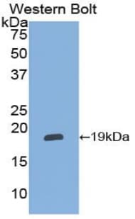 SERPINF2 / Alpha-2-Antiplasmin Antibody (aa348-491, Cy3)